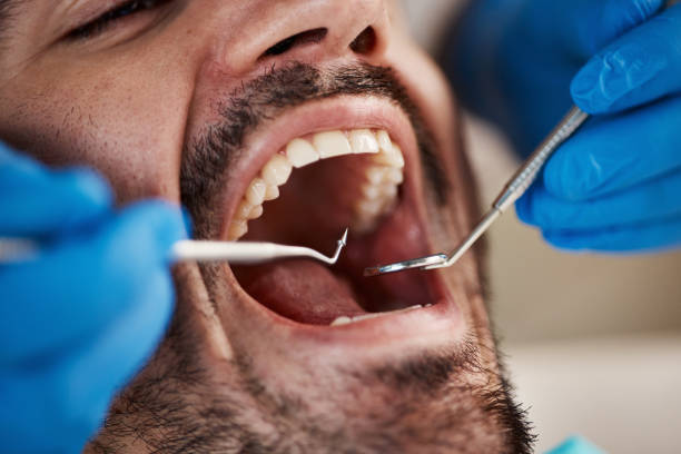 Best Emergency Care for Gum Disease in Crosbyton, TX