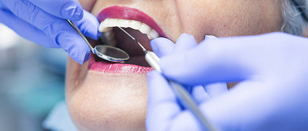 Best Emergency Wisdom Tooth Extraction in Crosbyton, TX